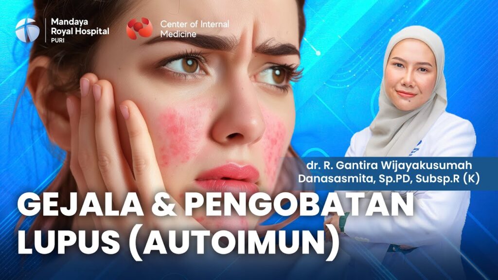 Penjelasan tentang Penyakit Lupus oleh dr. Gantira, Dokter Ahli Lupus dari RS Mandaya Puri