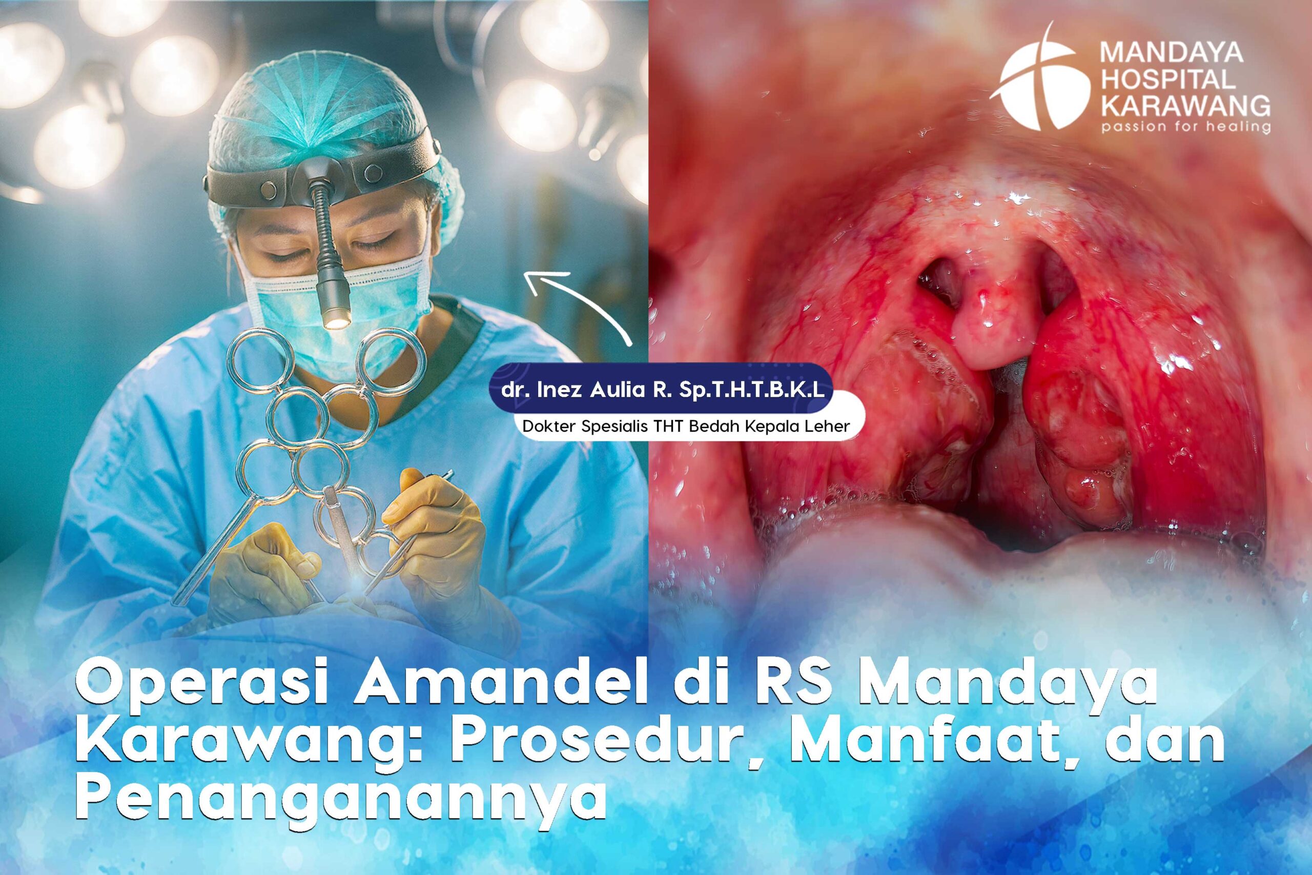 Operasi Amandel di RS Mandaya Karawang : Prosedur, Manfaat & Penanganannya