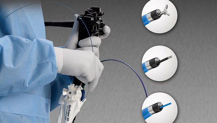 Teknologi Endoskopi Canggih Hadir di Mandaya Bernama SpyGlass, Mampu Lakukan Biopsi & Memecahkan Batu Saluran Empedu hingga Pankreas