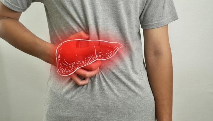 TARE Y-90 Liver Cancer Therapy, A Modern Non-Surgical Treatment at Mandaya Royal Puri Hospital