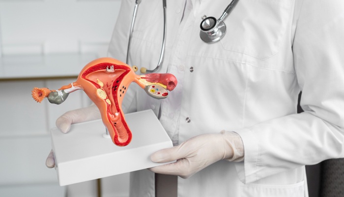 Are Uterine Fibroids Dangerous? Recognize the Symptoms and Complications