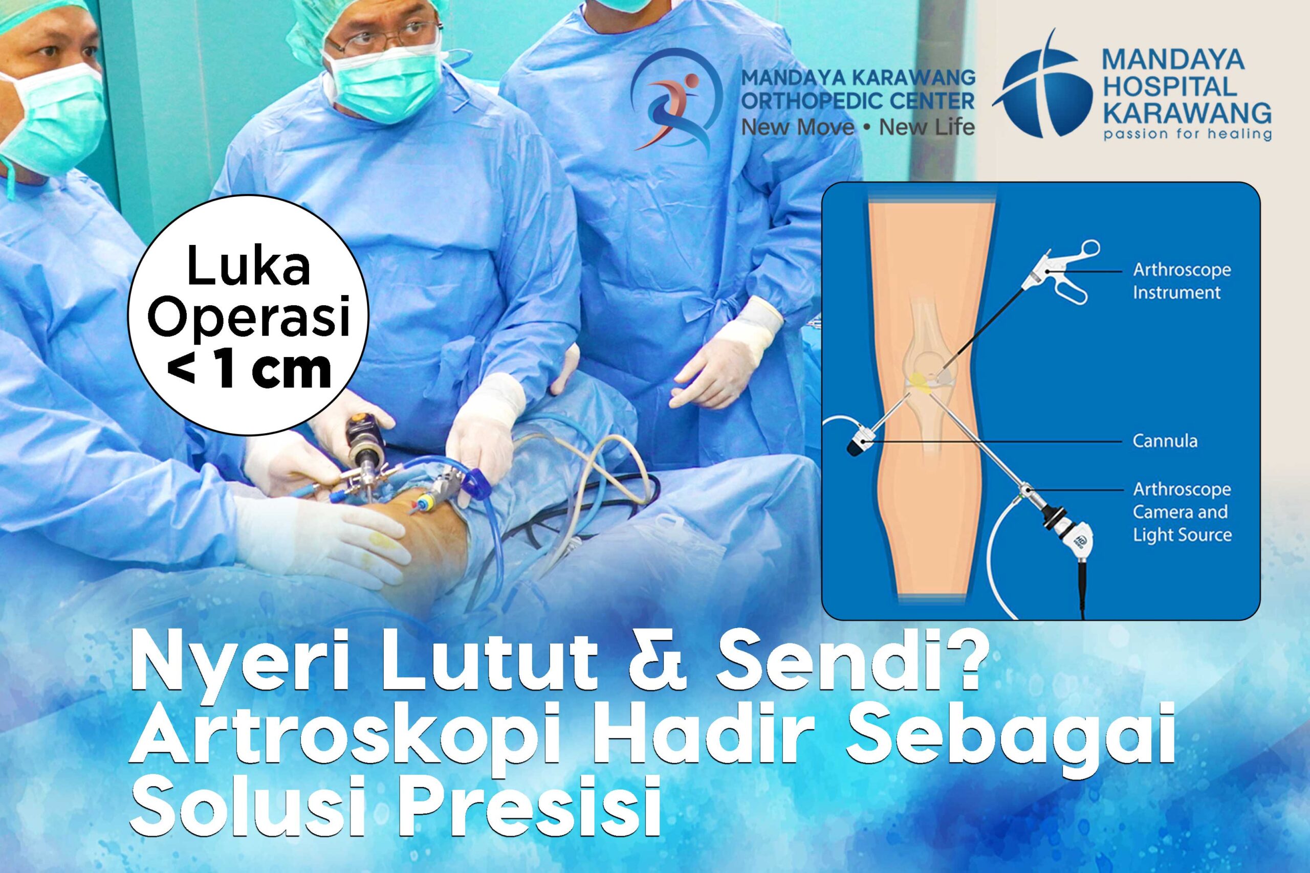 Nyeri Lutut & Sendi? Artroskopi Hadir Sebagai Solusi Presisi di Karawang