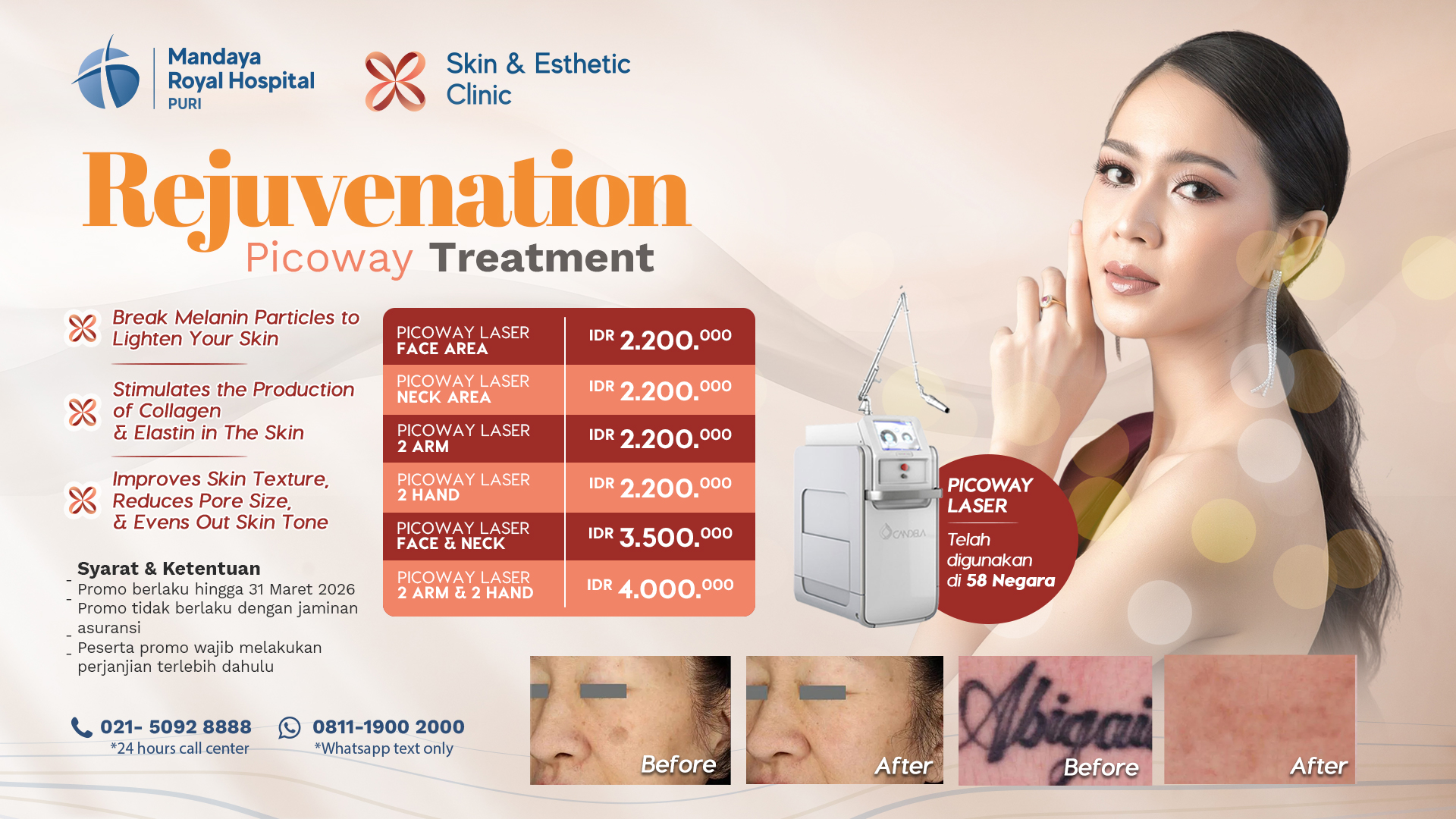 Harga Paket Picoway Mandaya Royal Hospital Puri 2026