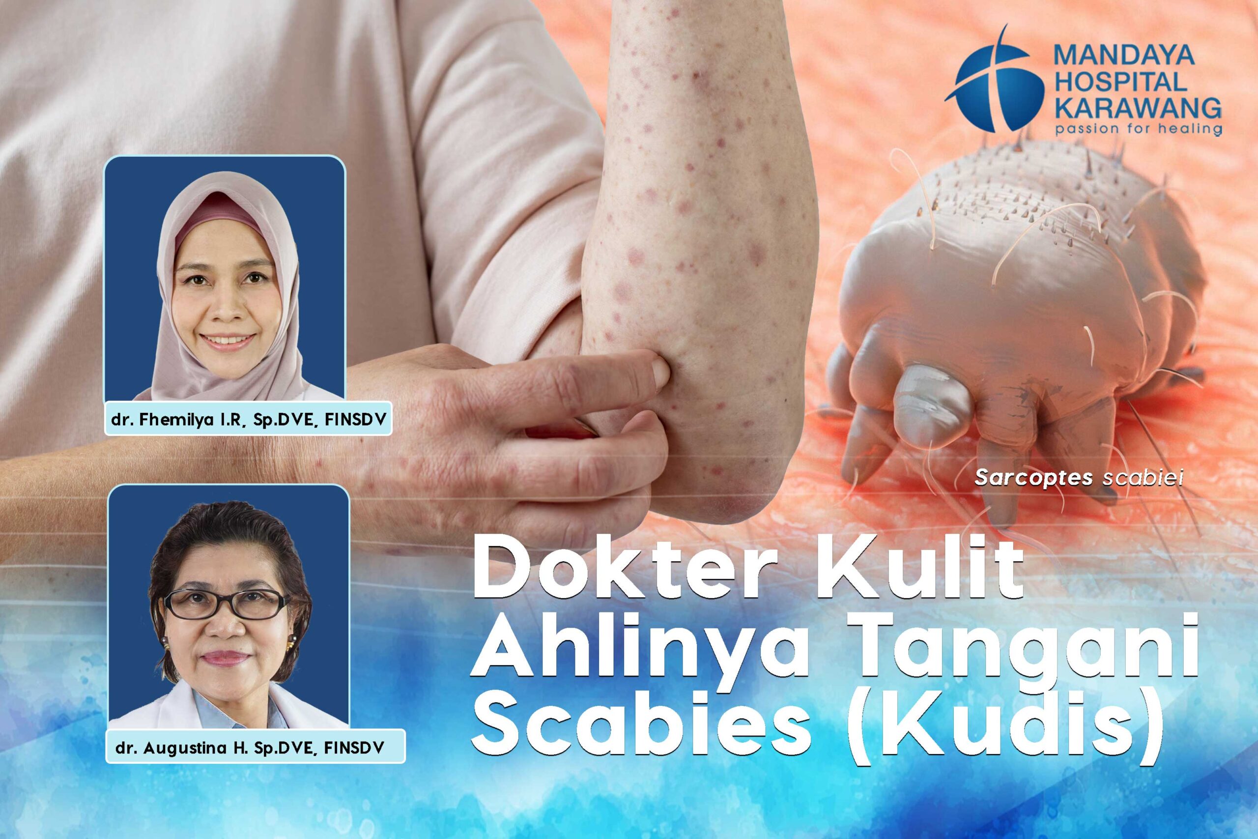 Dokter Kulit Karawang, Ahli Menangani Scabies (Kudis) Secara Tuntas