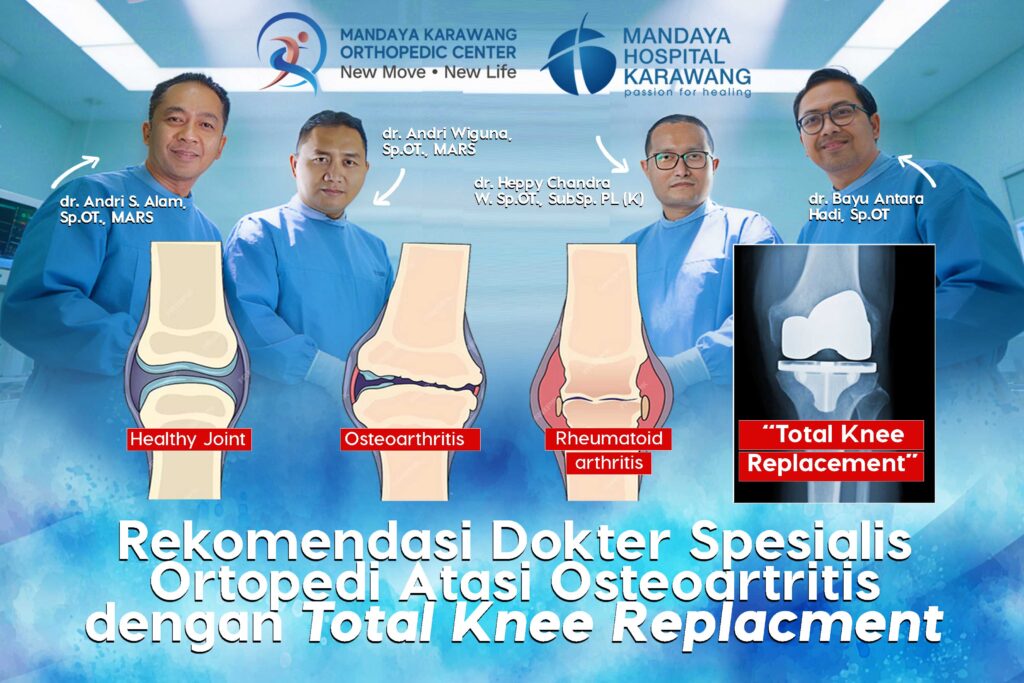 Dokter Ortopedi Atasi Osteoartritis dengan Teknologi Modern Total Knee Replacement di Karawang