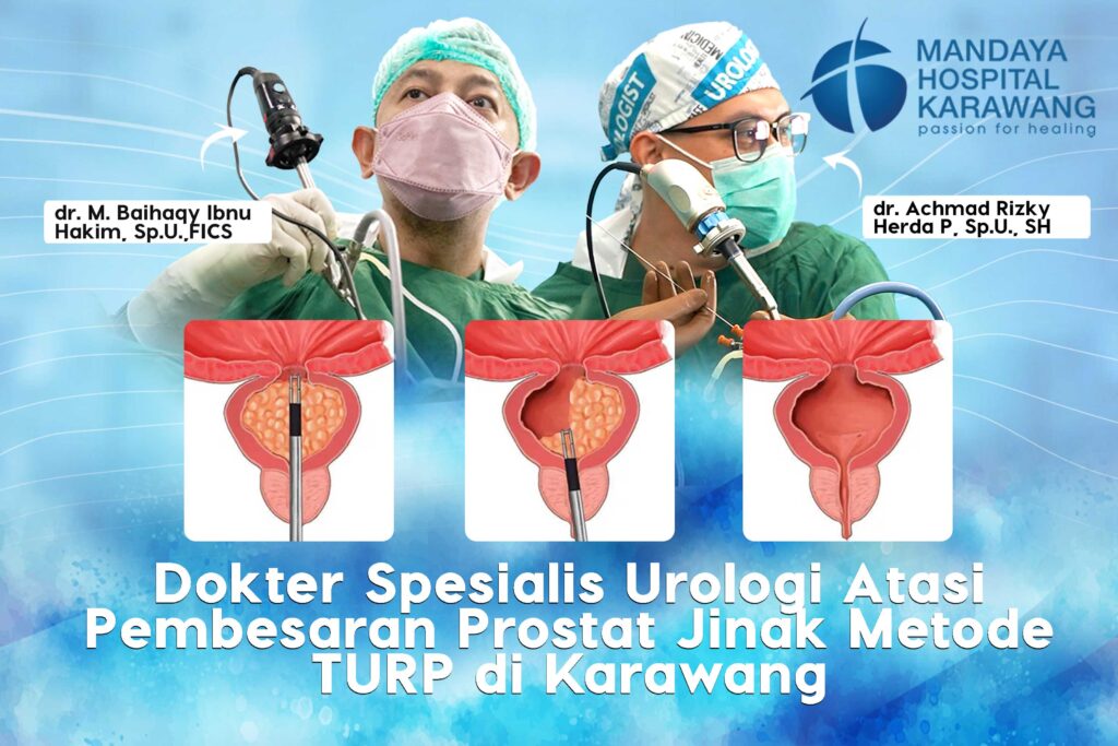 Dokter Urologi Karawang Atasi Pembesaran Prostat Jinak Metode TURP
