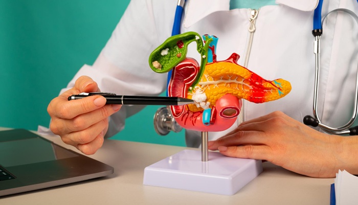 3 Clinical Study Findings on the Effectiveness of HIFU for Pancreatic Cancer at Mandaya Royal Hospital Puri