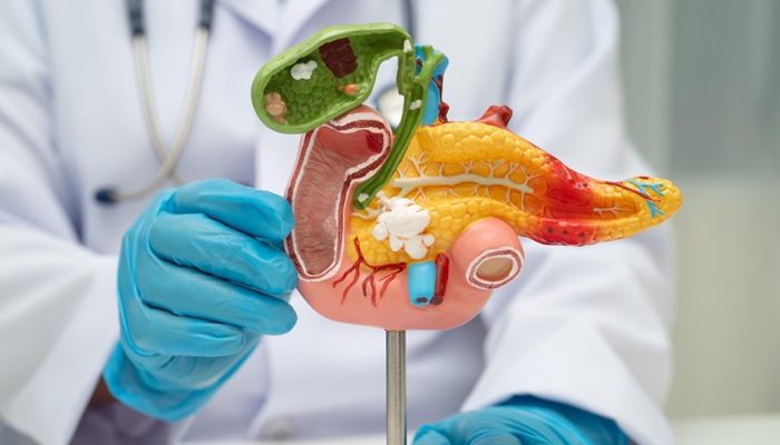 6 Advantages of Pancreatic Cancer Treatment with HIFU: From Pain Relief to Tumor Shrinkage