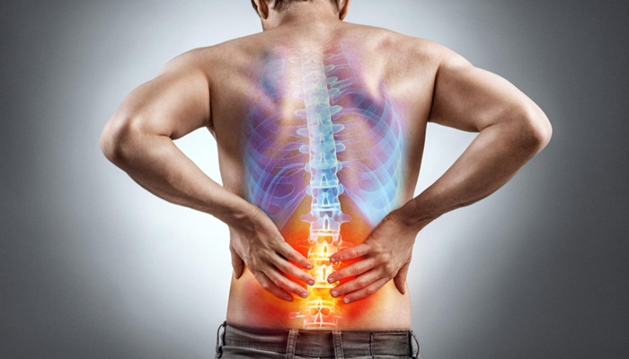 Patah Tulang Belakang dan Saraf Terjepit Ditangani dr. Fachry di RS Mandaya Puri dengan Operasi Pasang Implan