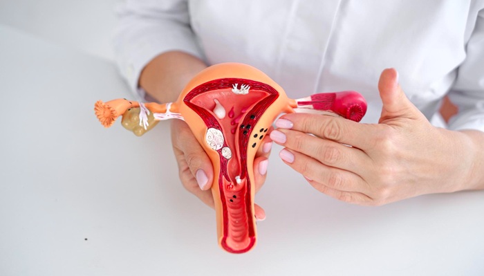 Pengobatan Alternatif Medis untuk Miom Rahim Metode HIFU Ablation: Tanpa Operasi, Tanpa Luka