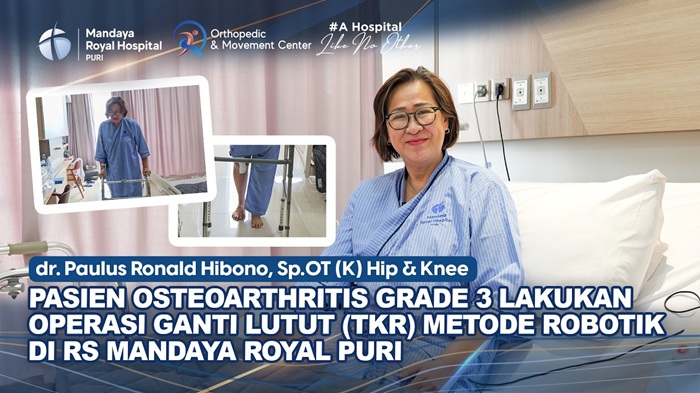 Operasi Ganti Lutut oleh dr. Paulus di RS Mandaya Puri untuk Pengapuran Lutut Grade 3-4