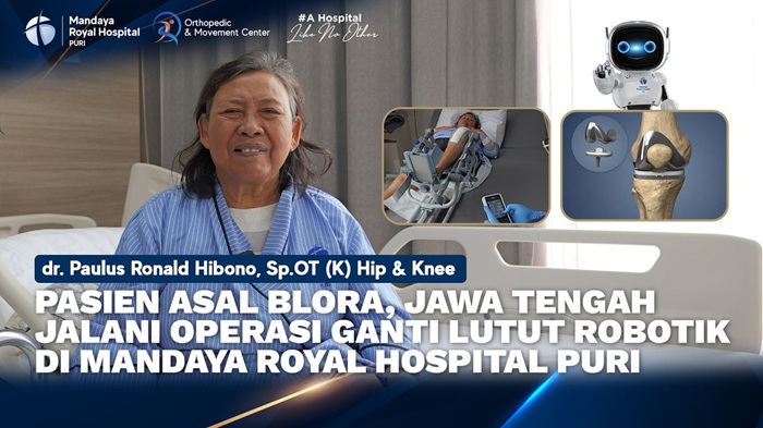 Pengalaman Pasien Blora Jawa Tengah, Operasi Ganti Lutut Metode Robotik di RS Mandaya Puri oleh dr. Paulus
