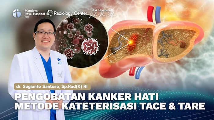 Dokter Ahli TACE dan TARE Y-90 untuk Pengobatan Kanker Hati di RS Mandaya Puri