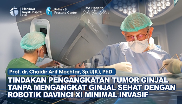 Tindakan Angkat Tumor Ginjal 6x8 cm dengan Robot Da Vinci Xi oleh Prof. Chaidir di RS Mandaya Royal Puri