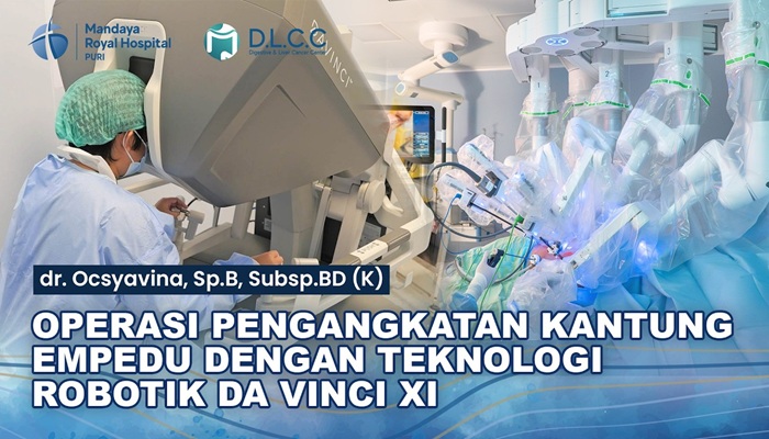 Pengangkatan Kantung Empedu dengan Robot Bedah Da Vinci Xi oleh dr. Ocsyavina, Sp.B. Subsp.BD (K) di RS Mandaya Puri