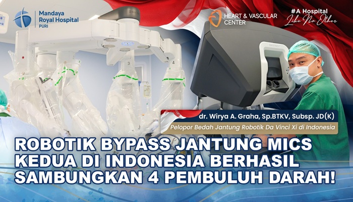 Tindakan Bypass Jantung Minimal Invasif Robotik Ke-2 di RS Mandaya Puri Dikerjakan oleh dr. Wirya