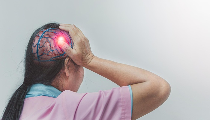 Kenali Meningioma, Jenis Tumor Otak yang Paling Sering Ditemui