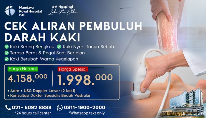 Paket Pemeriksaan Aliran Pembuluh Darah Kaki 2026 – Mandaya Royal Hospital Puri