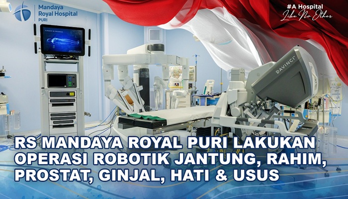 RS Mandaya Royal Puri Gunakan Robot Da Vinci Xi untuk Operasi Jantung, Rahim, Prostat, Ginjal, Hati, hingga Usus