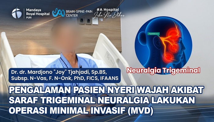 Pengalaman Pasien Nyeri Wajah Sebelah Jalani Operasi MVD dengan Dr. Joy di RS Mandaya Royal Puri